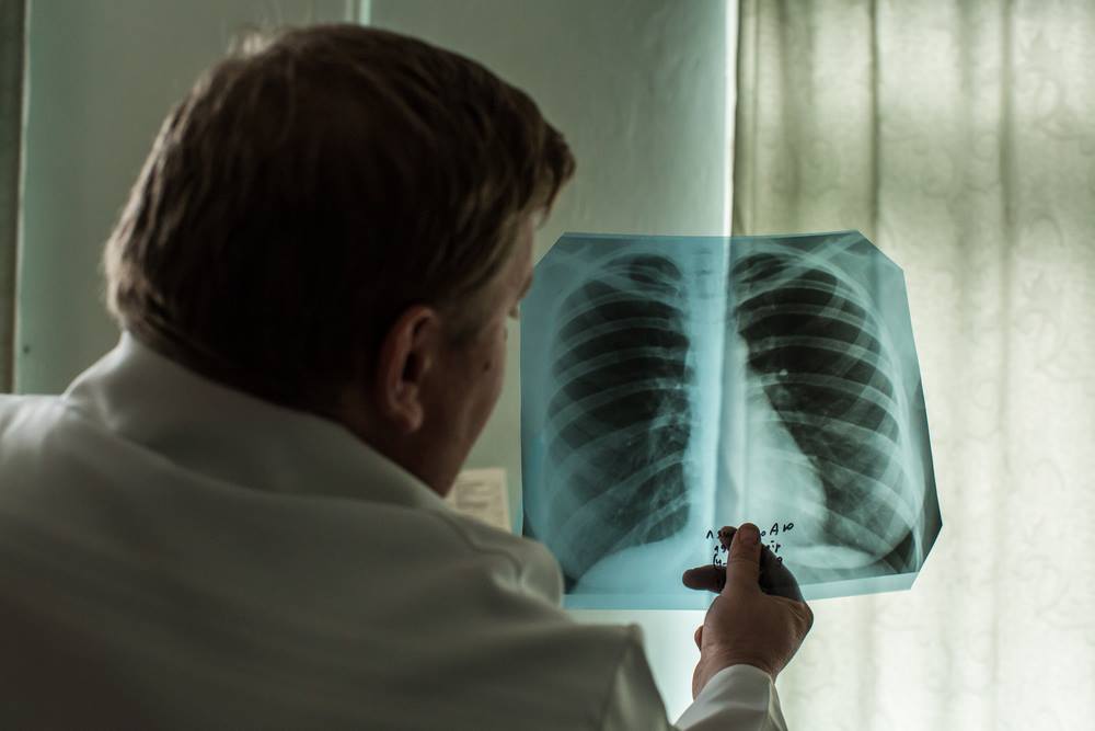 На фоне пандемии коронавируса в Брянской области заговорили об угрозе туберкулеза