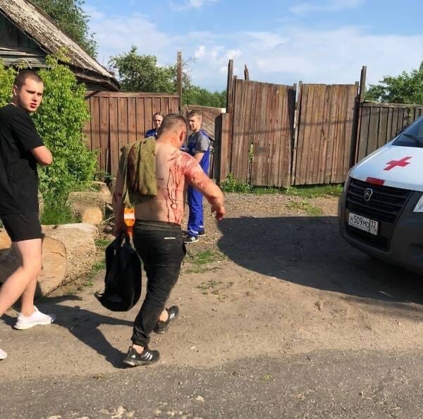 Медики Брянской области рассказали о состоянии пострадавших от обстрела ВСУ города Клинцы