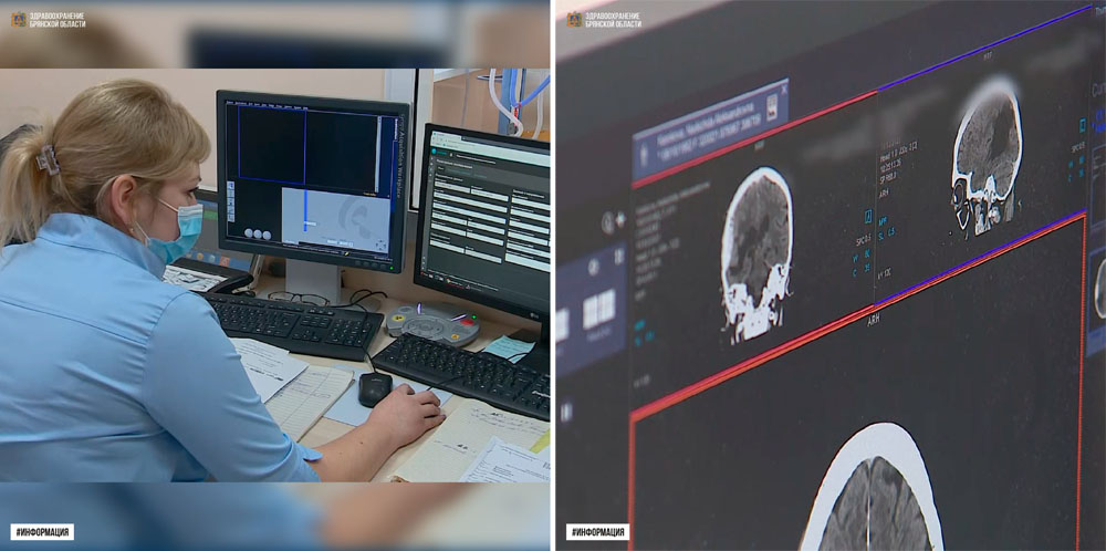 Врачам Брянской области флюорограммы и рентгенограммы расшифровывает искусственный интеллект